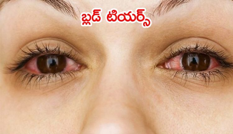 నెల‌స‌రి స‌మ‌యంలో ఆమె క‌ళ్ల‌ నుంచి ర‌క్తం