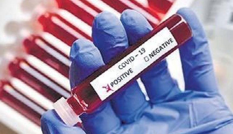 ఏపీలో పెరుగుతున్న కరోనా కేసులు.. కొత్తగా 380 కేసులు