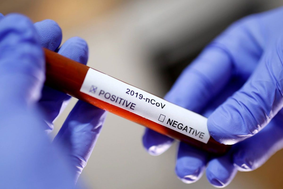 యాదాద్రి ఆలయంలో మరో 32 మంది సిబ్బందికి కరోనా