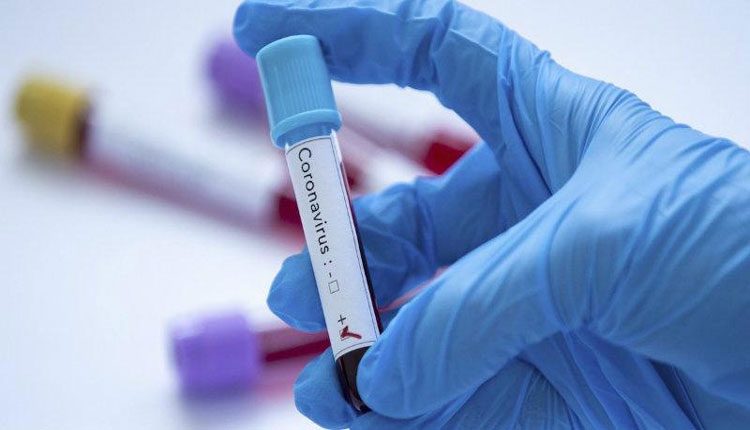 రోజు 50వేల కరోనా పరీక్షలు