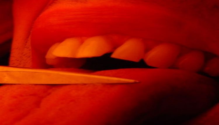 భార్యతో వాదించలేక.. నాలుక కోసుకున్న భర్త