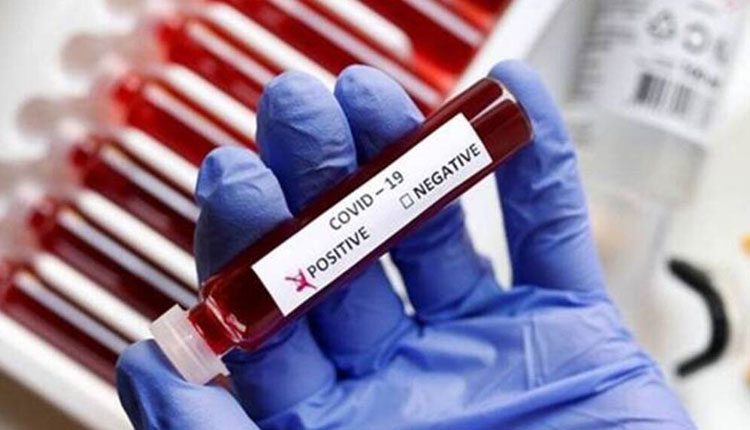 క‌రోనా వ్యాక్సిన్ తీసుకున్న వైద్యుడికి కొవిడ్ పాజిటివ్‌