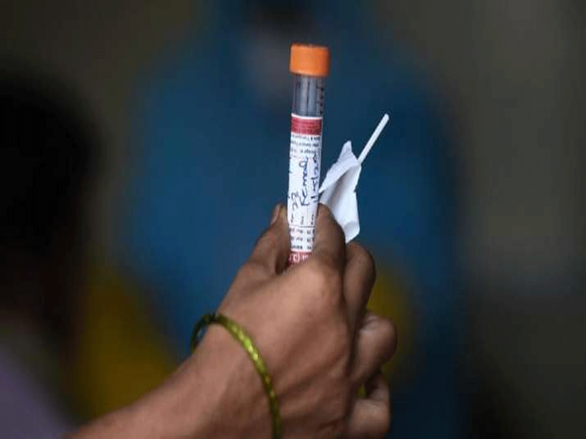 ఇలాంటి వారు వైరస్ బారిన పడే అవకాశాలు తక్కువ : సీఎస్ఐఆర్ సెరో స‌ర్వేలో వెల్ల‌డి