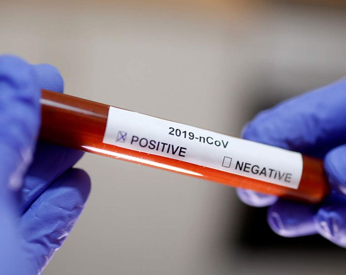 ఊళ్లో పండుగ.. 93 మందికి కరోనా