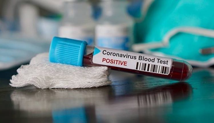 ఐఐటీలో 52 మంది విద్యార్థులకు కరోనా పాజిటివ్‌