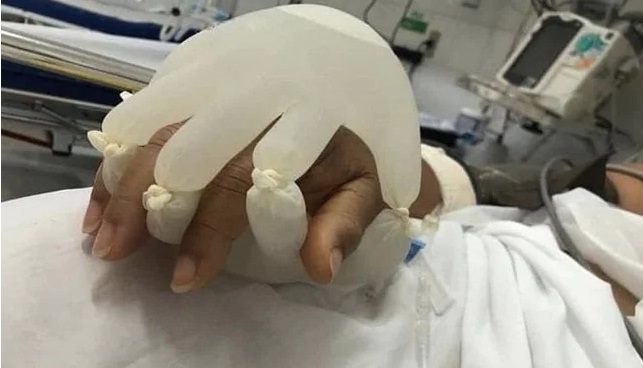 కరోనా రోగులకు కృత్రిమ ఆత్మీయ స్పర్శ