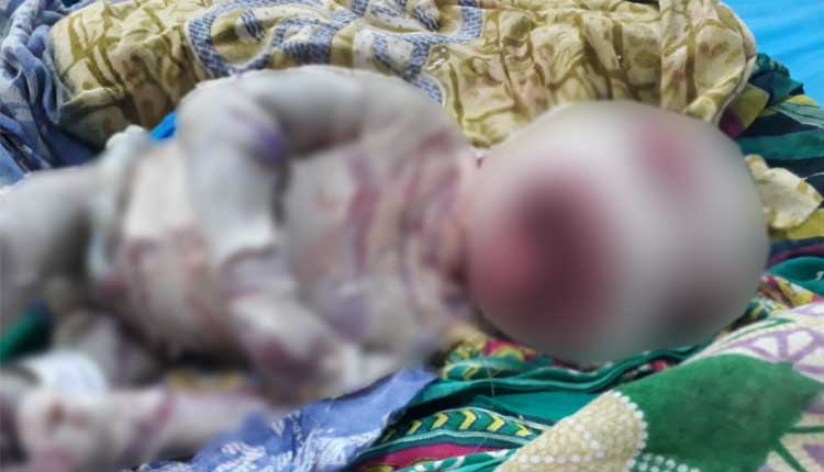 పంది త‌ల‌, చేప చ‌ర్మం.. ఒడిశాలో వింత శిశువు జ‌న‌నం..!