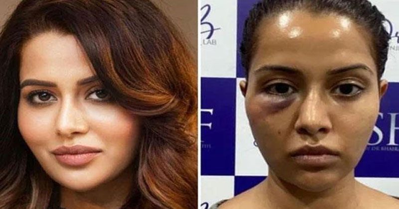 అందంగా ఉన్న బిగ్ బాస్ బ్యూటీని అంద విహీనంగా మార్చిన డాక్ట‌ర్