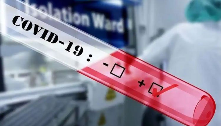 బోధన్‌ ఎమ్మెల్యే షకీల్‌కు కరోనా పాజిటివ్‌