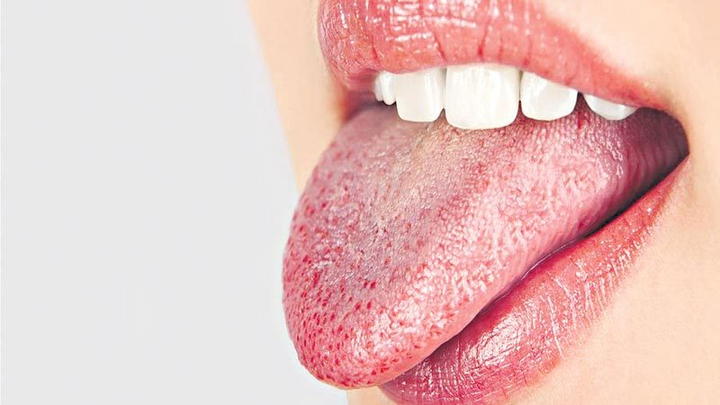 నోటిపొక్కులూ వైరస్‌ లక్షణమే