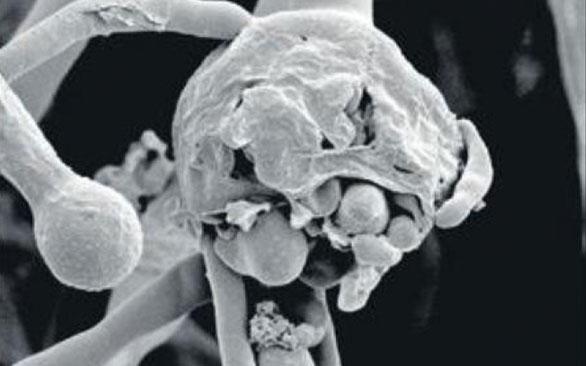 స్ట్రెయిన్లతోనే బ్లాక్‌ పంజా