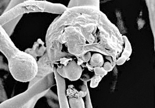 బాధితుల్లో వాయునాళాలు బంద్‌