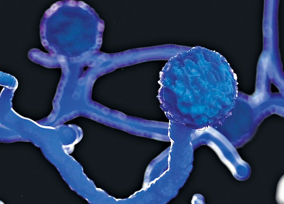 బ్లాక్‌ ఫంగస్‌ ఇంజెక్షన్లకు డిమాండ్‌