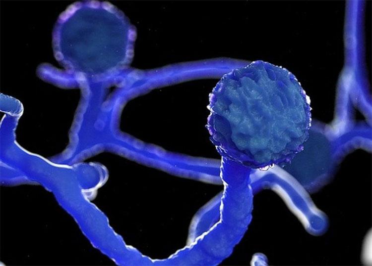 ఐదు మార్గాల్లో మ్యూకోర్మైకోసిస్‌ దాడి