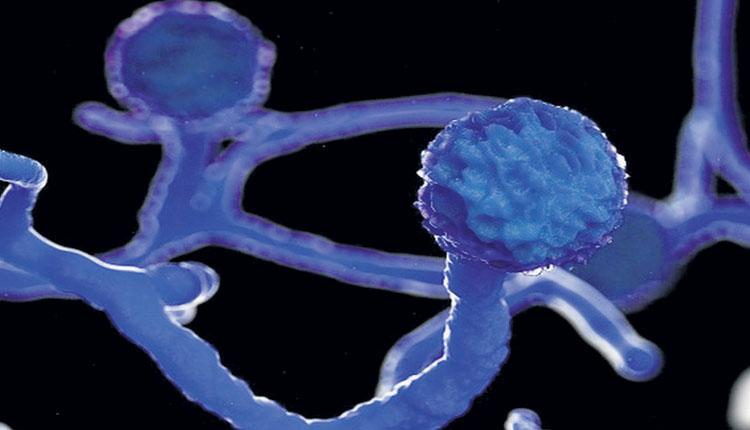 హడలెత్తిస్తున్న బ్లాక్‌ ఫంగస్‌