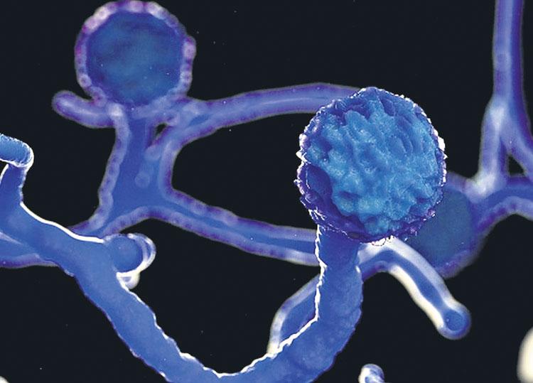 బ్లాక్‌ ఫంగస్‌తో జరభద్రం