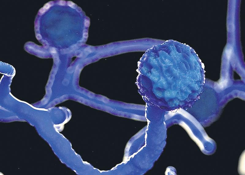 బ్లాక్‌ ఫంగస్‌పై ప్రత్యేక ఫోకస్‌