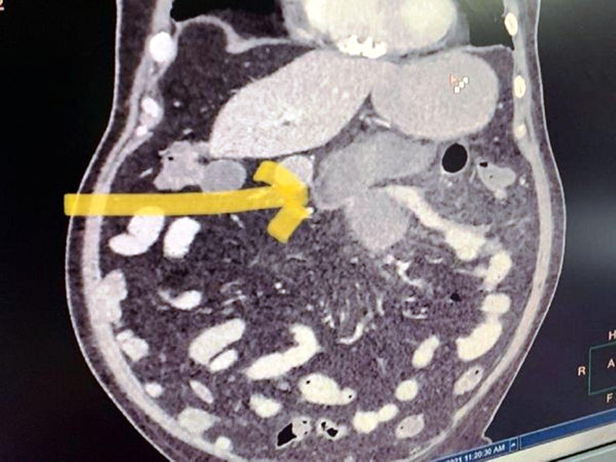 బ్లాక్ ఫంగ‌స్ పెరుగుద‌ల‌కు ఇవీ కార‌ణాలు.. ఎయిమ్స్ నిపుణుడి కుండ‌బ‌ద్ధ‌లు!