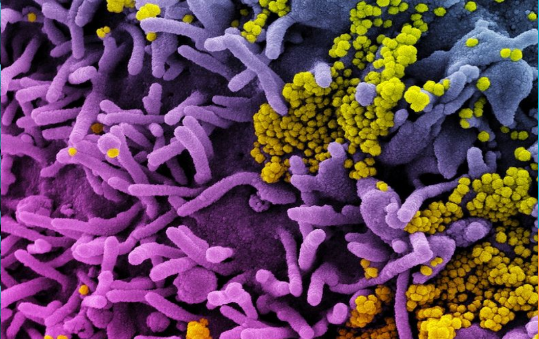 బ్లాక్ ఫంగస్ లక్షణాలు ఎలా వుంటాయి..?