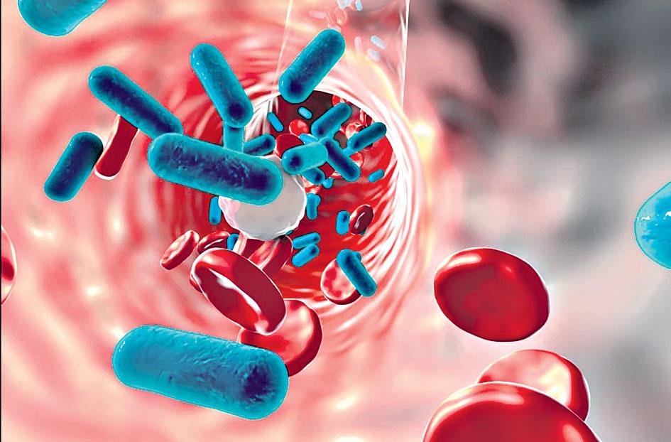 ఇన్ఫెక్షన్‌ గుట్టురట్టు