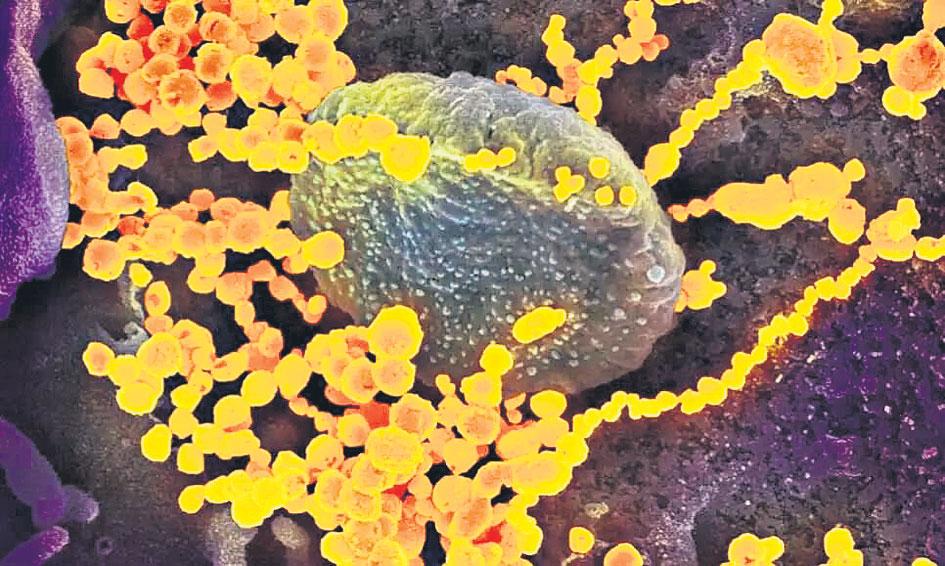 యెల్లో ఫంగస్‌! యూపీలోని ఓ వ్యక్తిలో గుర్తింపు