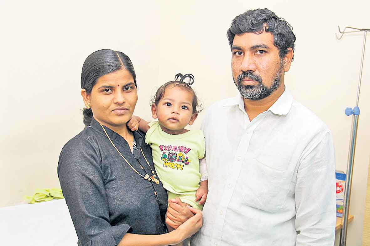 9 నెలల శిశువుకు ఎక్మో చికిత్స