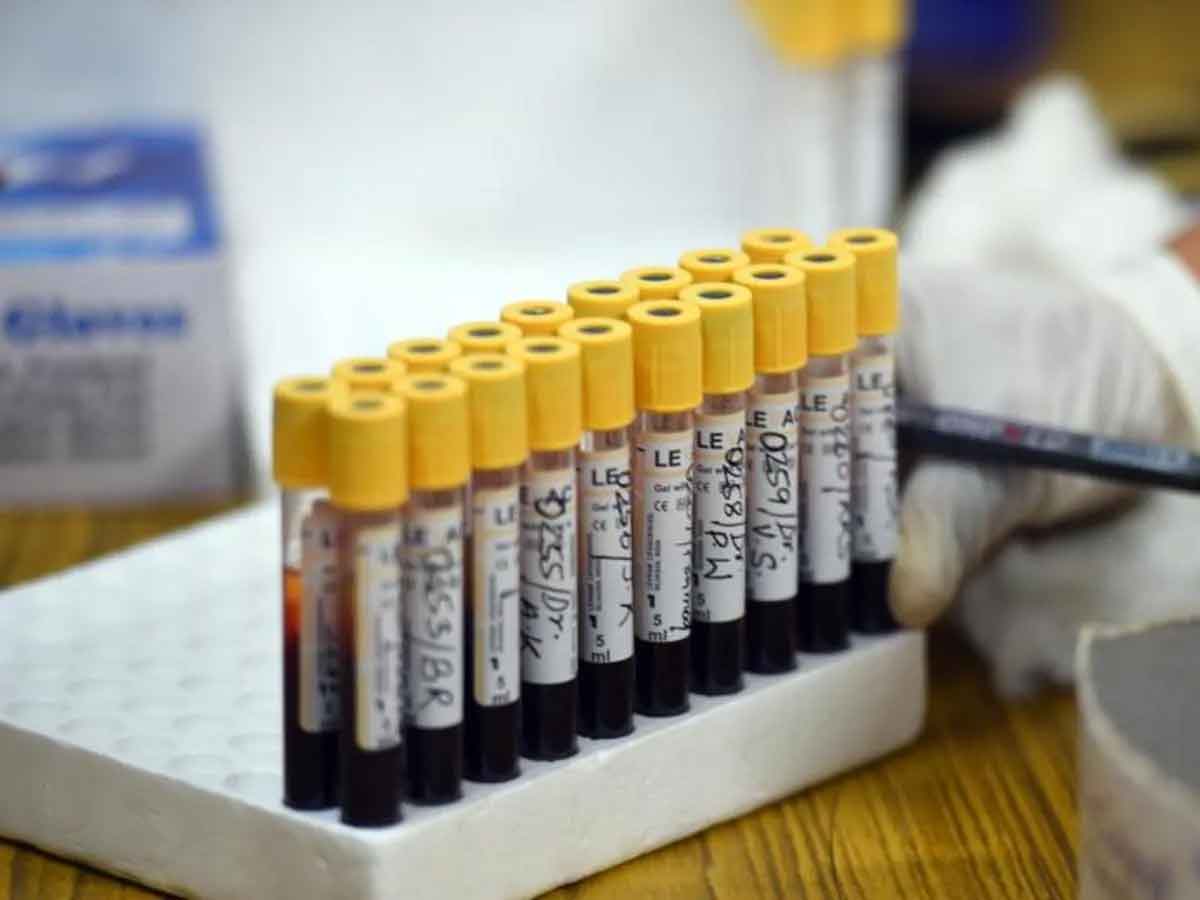 వ్యాప్తి అంచ‌నా : ఈ నెల‌లో ఐసీఎంఆర్ సెరో స‌ర్వే