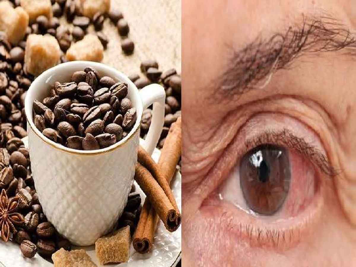 కెఫిన్ అధిక వినియోగంతో గ్ల‌కోమా స‌మ‌స్య‌