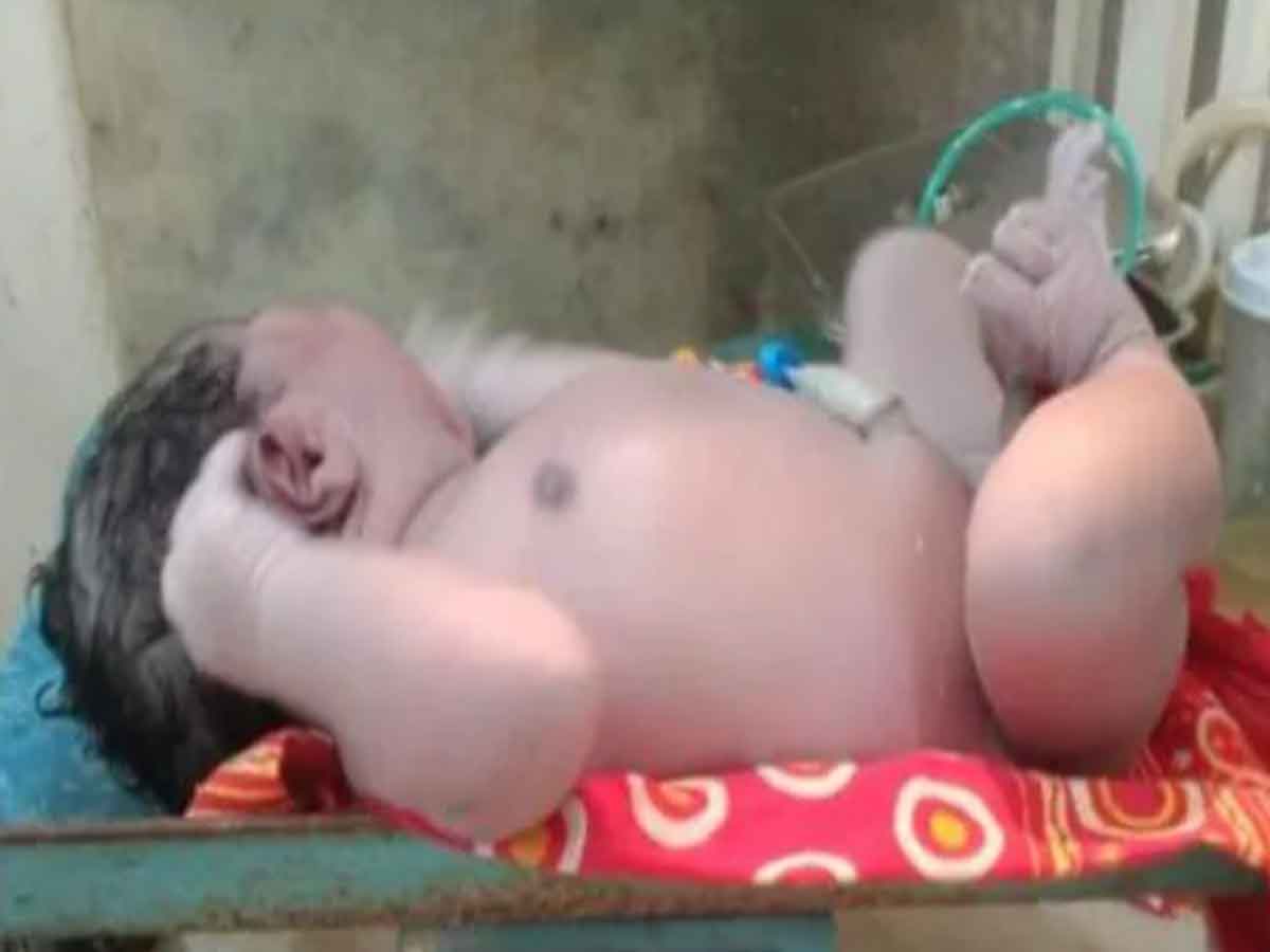 5.2 కేజీల బ‌రువున్న బాబుకు జ‌న్మ‌నిచ్చిన అస్సాం మ‌హిళ‌