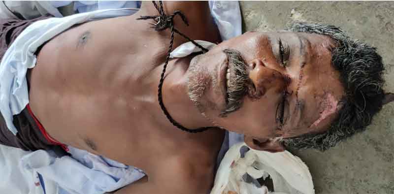 చికిత్స పొందుతూ వ్యక్తి మృతి