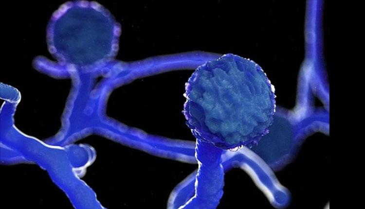 400 దాటిన బ్లాక్‌ ఫంగస్‌ ఆపరేషన్లు