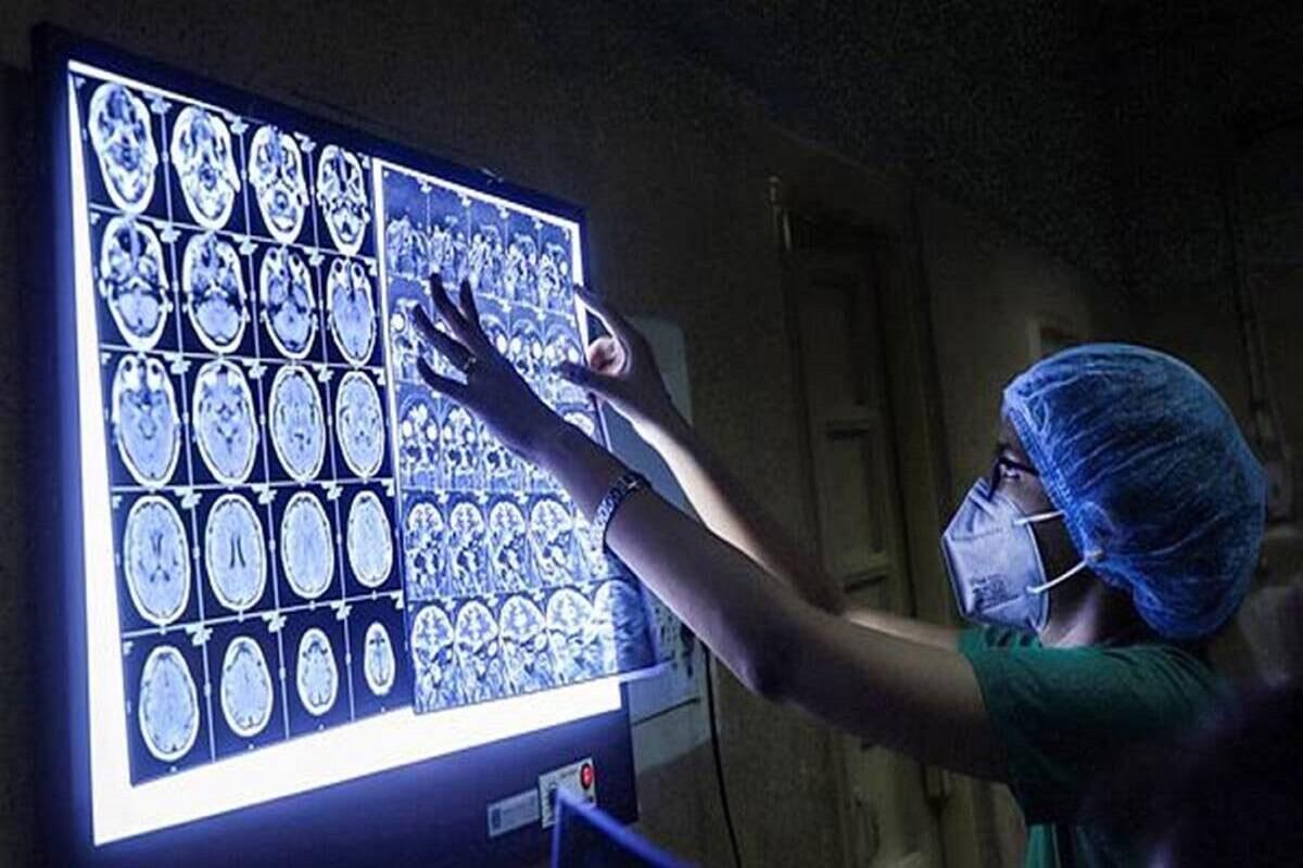 కర్ణాటకలో పెరుగుతున్న బ్లాక్‌ ఫంగస్‌ కేసులు