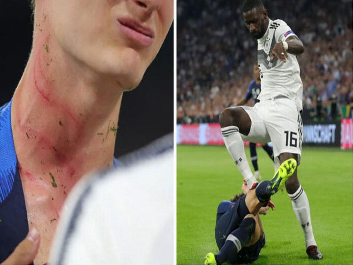 గ్రౌండ్‌లో కుప్ప‌కూలిన మ‌రో ప్లేయ‌ర్‌