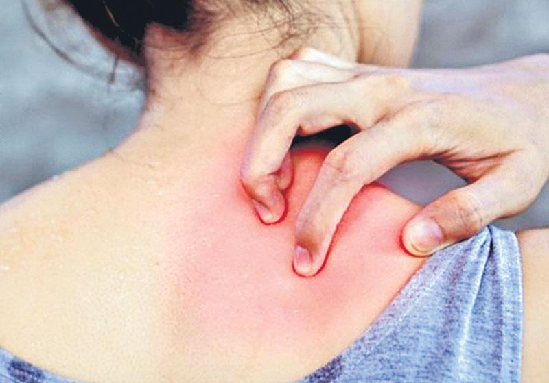 సిద్దిపేటలో చర్మ సంబంధ జబ్బుల చికిత్స కేంద్రం