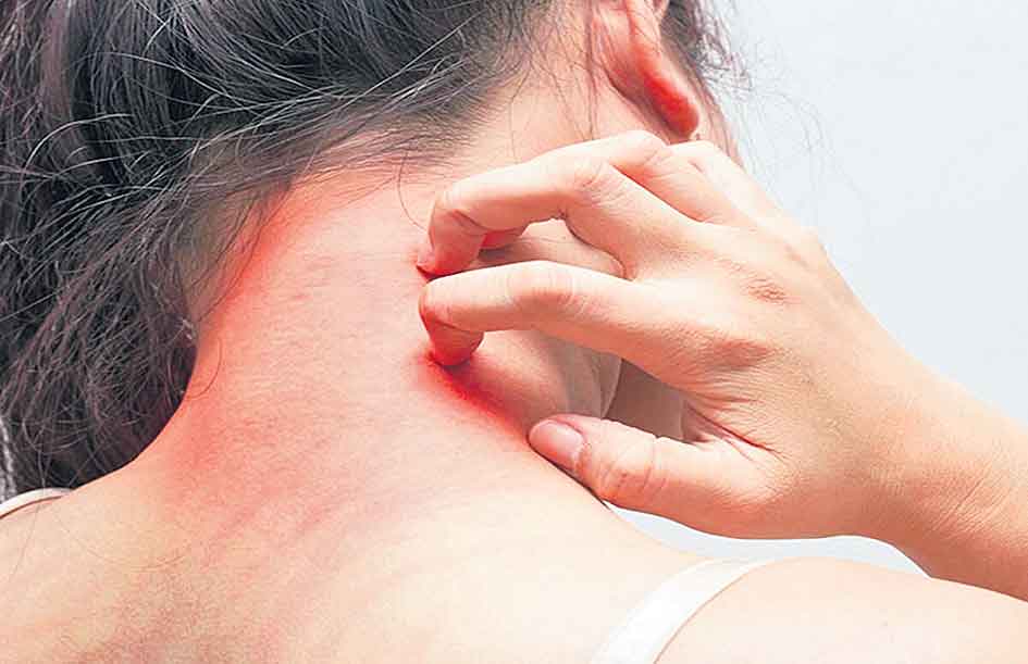 చర్మంపైనా.. కొవిడ్‌ దాడి!