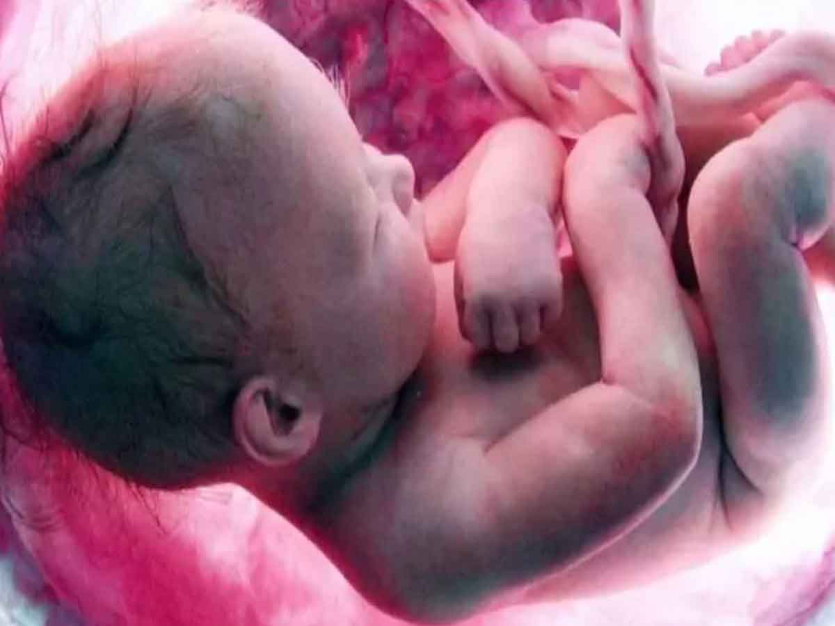Fetus in newborn’s womb| వైద్యరంగంలో సంచలనం.. తల్లి గర్భంలోనే గర్భం దాల్చిన శిశువు