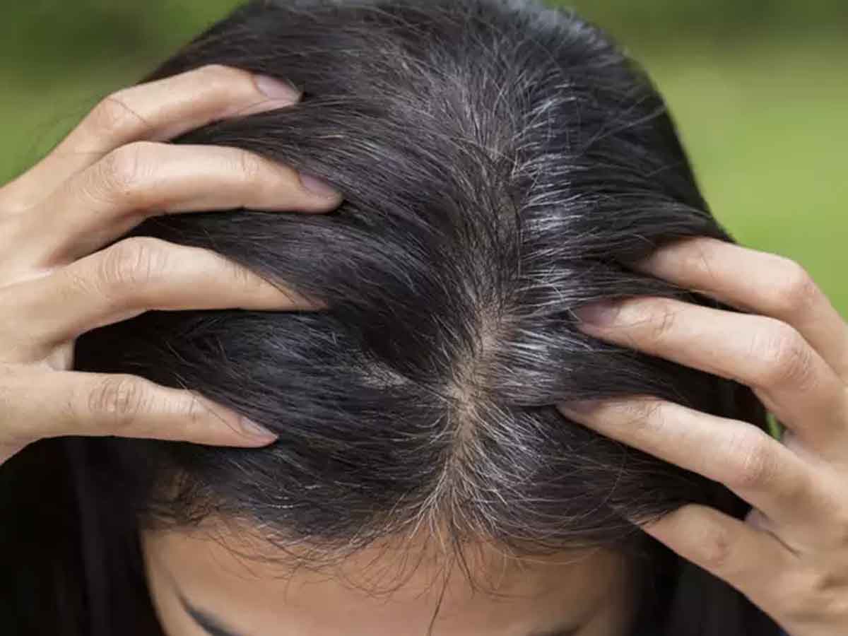 ఒత్తిడితో తెల్లటి జుట్టుకు ప్రత్యక్ష సంబంధం : తేల్చిన పరిశోధకులు