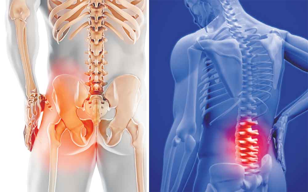 Bone Death :క‌రోనా పేషెంట్లూ జాగ్ర‌త్త‌..! ఎముక‌లు కుళ్లిపోయి, నిర్జీవంగా మారుతున్నాయ్‌