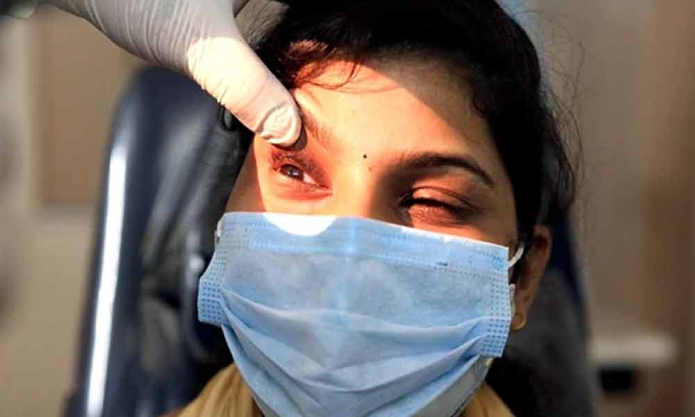 Black fungus : తిరగబెడుతున్న బ్లాక్‌ ఫంగస్‌!