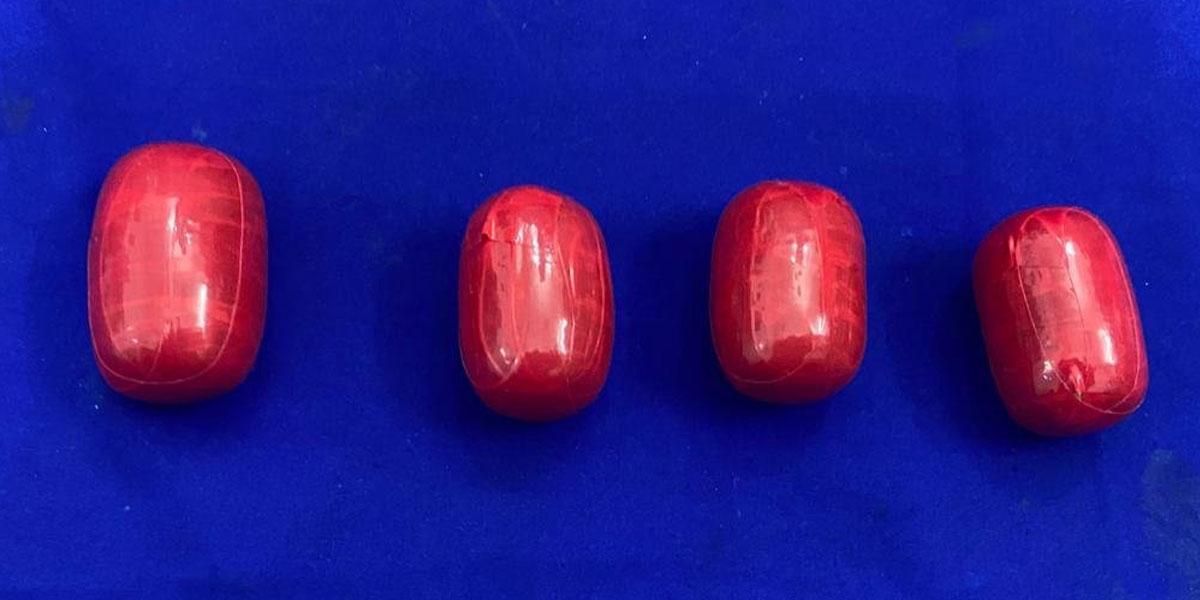 పాయువులో అర‌కిలోకు పైగా బంగారం..!