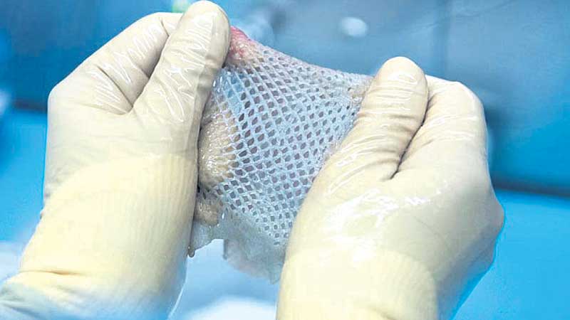 స్కిన్‌ బ్యాంక్‌ అంటే ఏమిటో మీకు తెలుసా?