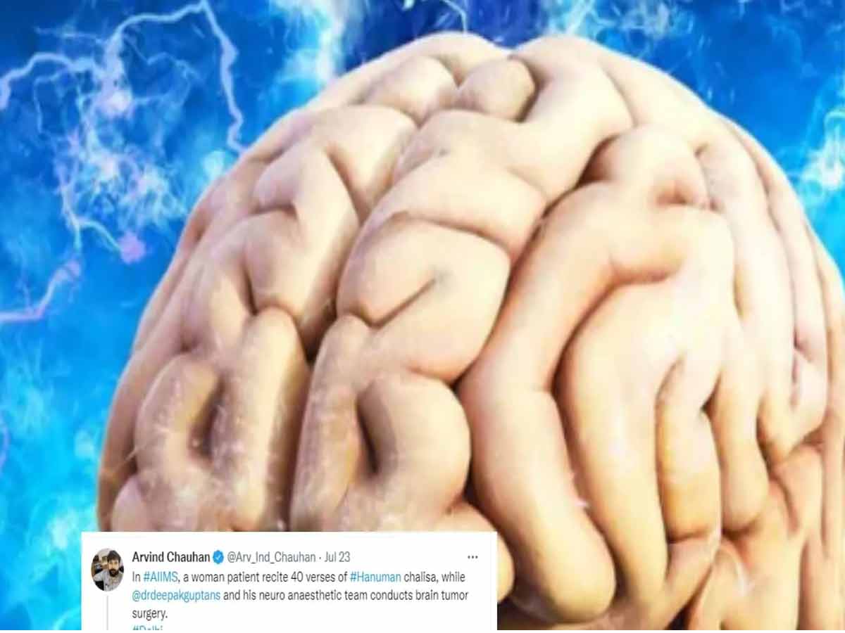 బ్రెయిన్ స‌ర్జ‌రీ జ‌రుగుతుండ‌గా హ‌నుమాన్ చాలీసా  ప‌ఠించిన‌ మ‌హిళ‌