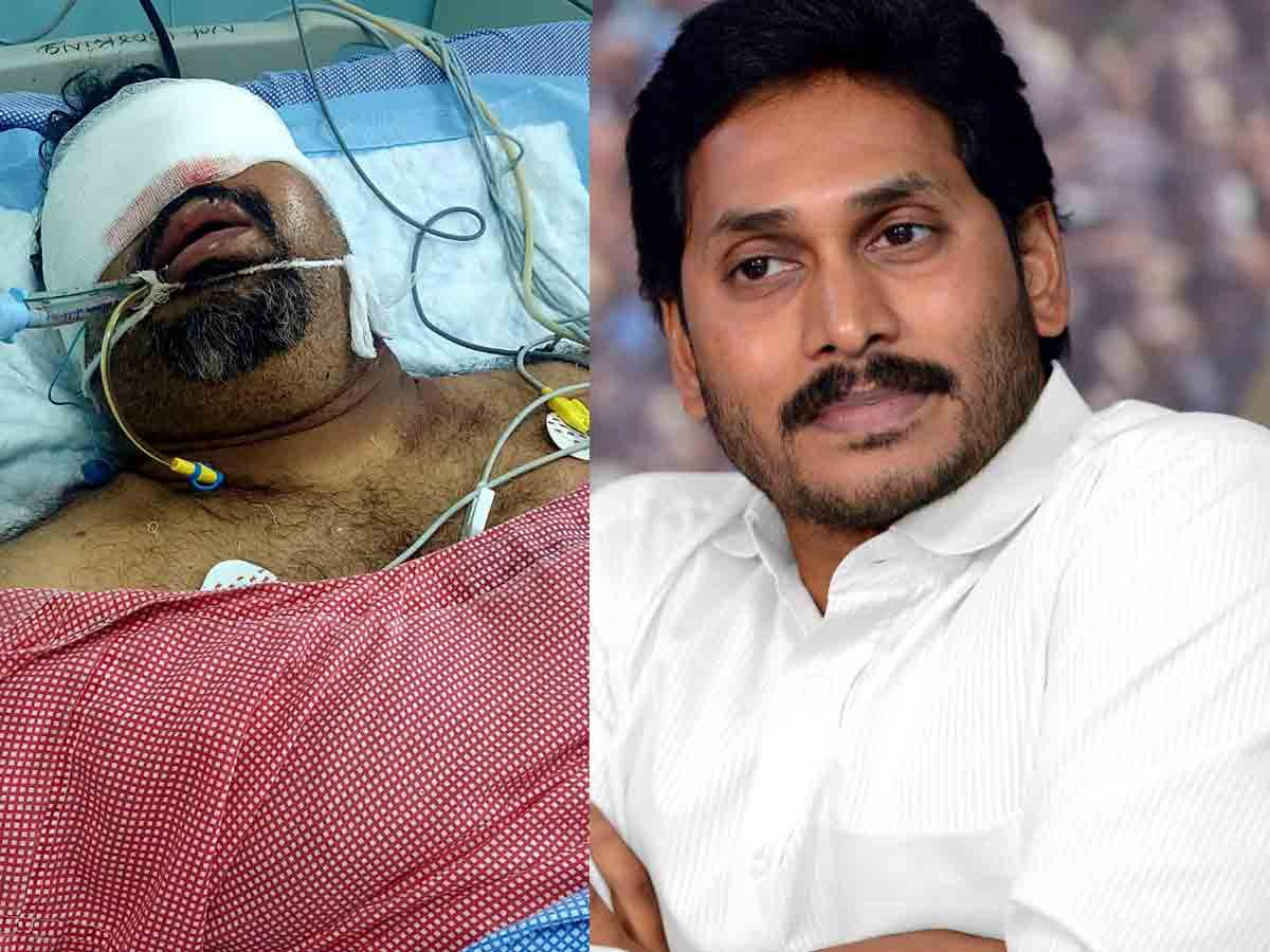 ఆస్ప‌త్రిలో క‌త్తి మ‌హేశ్‌ .. చికిత్స‌కు ఏపీ సీఎం జ‌గ‌న్ భారీ ఆర్థిక‌సాయం