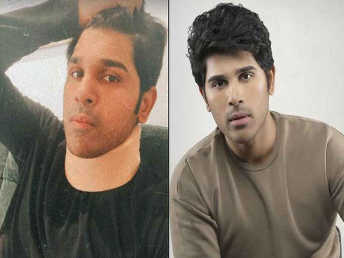 అల్లూవార‌బ్బాయికి గాయం..ఆందోళ‌న‌లో అభిమానులు