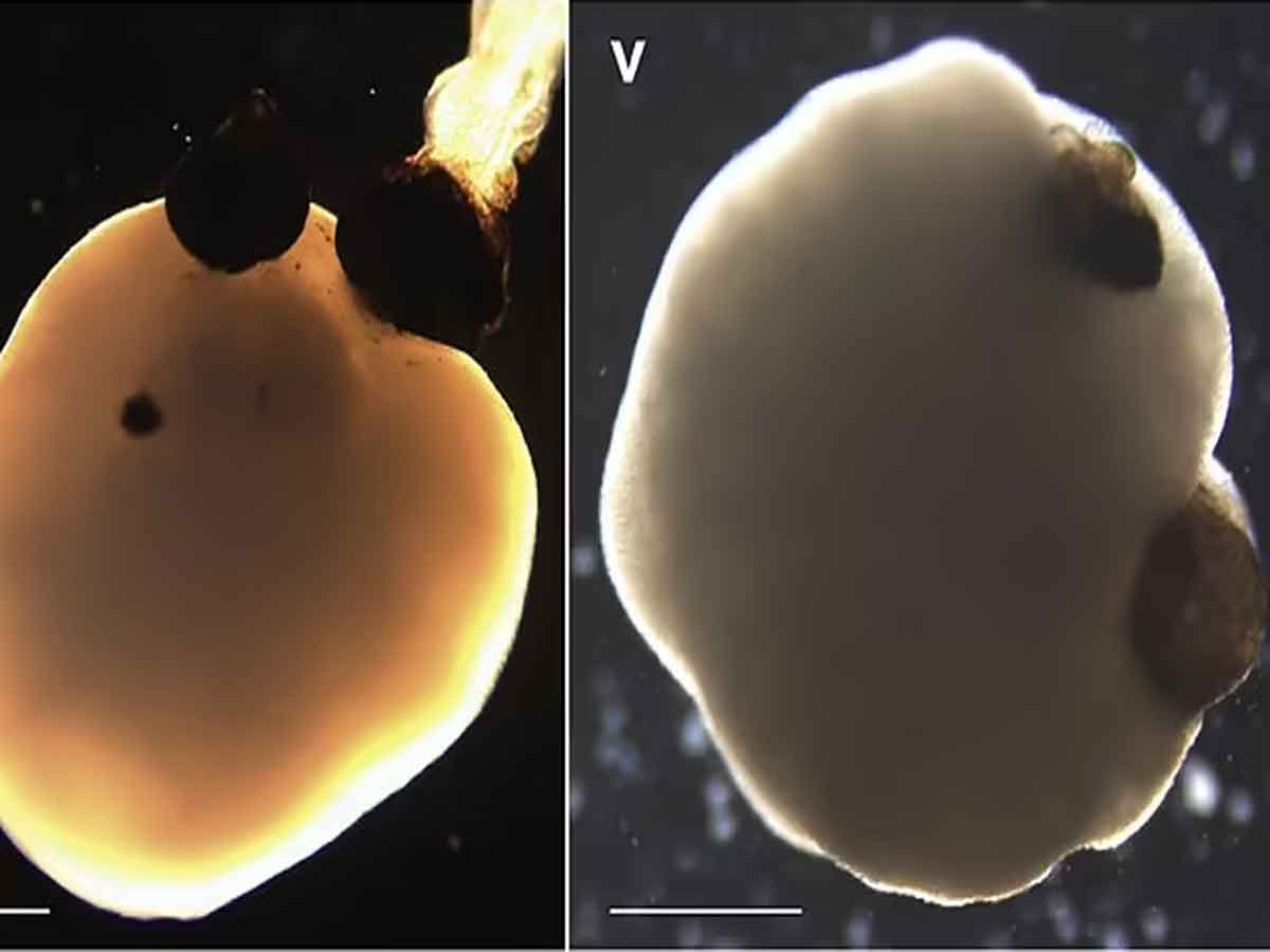 Artificial Human Brain : ల్యాబ్‌లో కృత్రిమ మానవ మెదడు సృష్టి