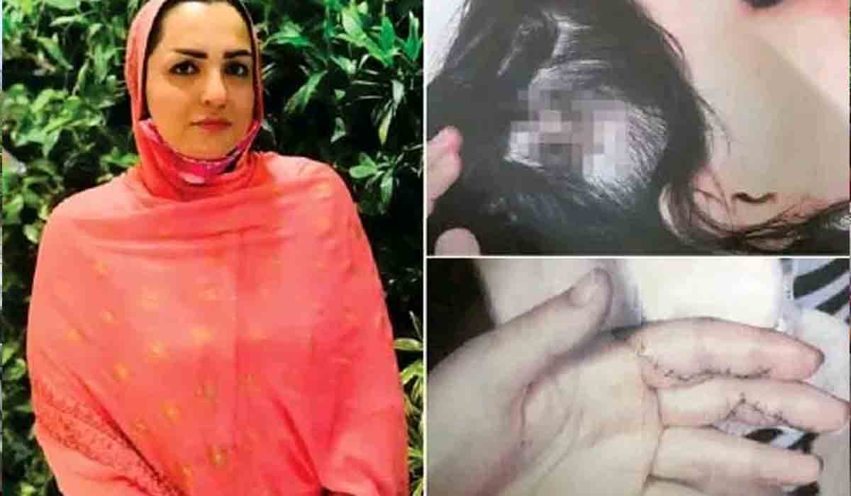 Fariba Akemi | తాలిబ‌న్లు చంపేస్తారేమో..  ఇండియాలోని ఓ ఆఫ్ఘ‌న్ మ‌హిళ ఆవేద‌న ఇదీ..