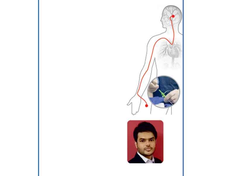 అరుదైన మెదడు వ్యాధికి అధునాతన చికిత్స