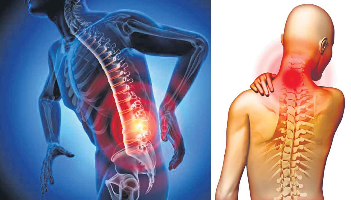 Back pain | సాఫ్ట్‌వేర్ ఉద్యోగుల‌ను ఎక్కువ‌గా వేధిస్తున్న ఈ స‌మ‌స్య‌ను ఎలా జ‌యించాలి?