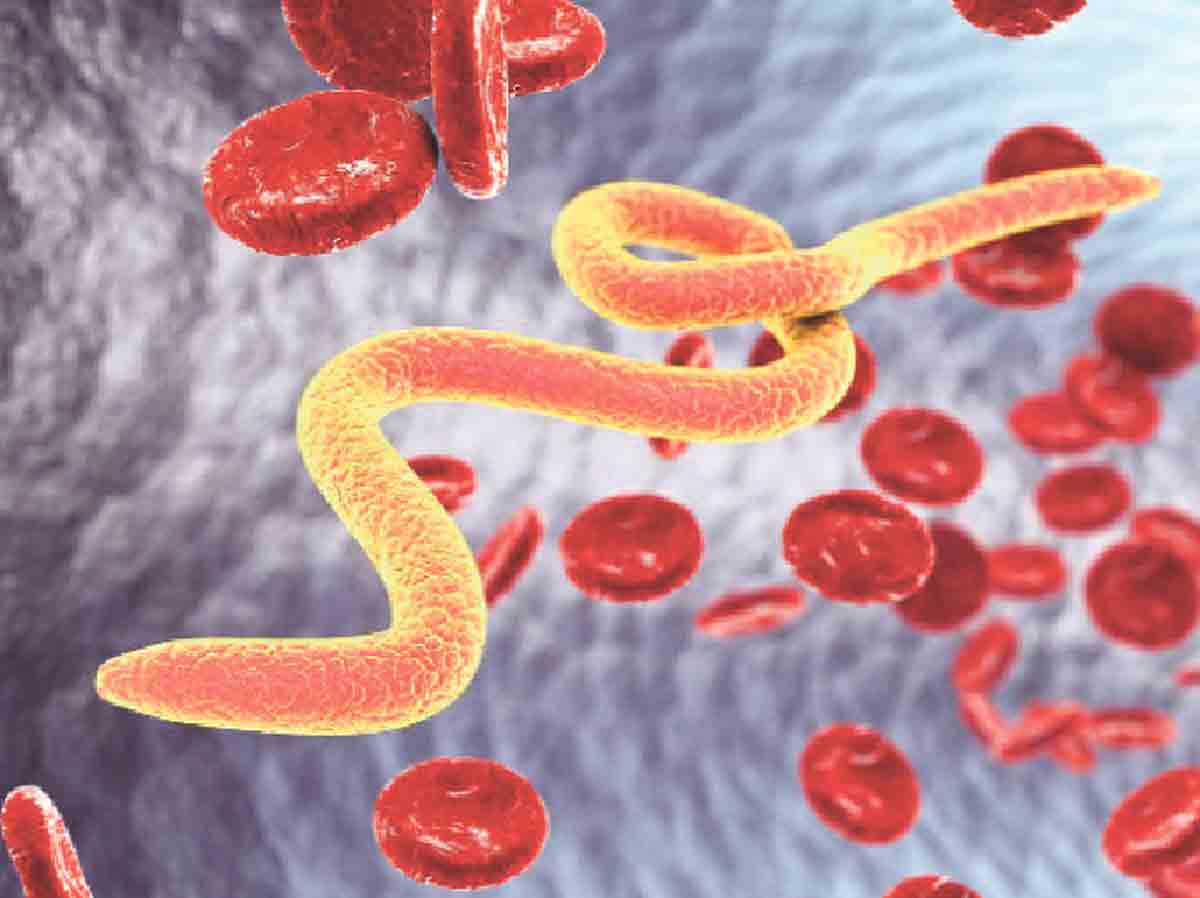 Child Health | మీ పిల్లలు నులిపురుగులతో ఇబ్బంది పడుతున్నారా.. ఇలా నివారించండి