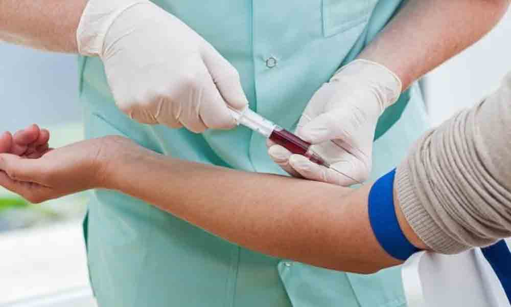 Delta Variant : అక్కడ 80శాతం డెల్టా వేరియంట్‌ కేసులే..!